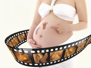 四维彩超和b超有什么区别