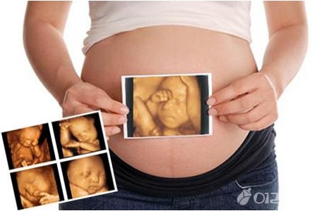 做四维彩超需要注意什么