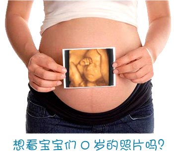 做了唐氏筛查还要做四维彩超吗