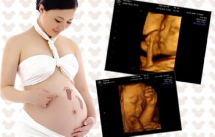 廊坊四维彩超知多少