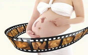 四维彩超前都需要注意什么？